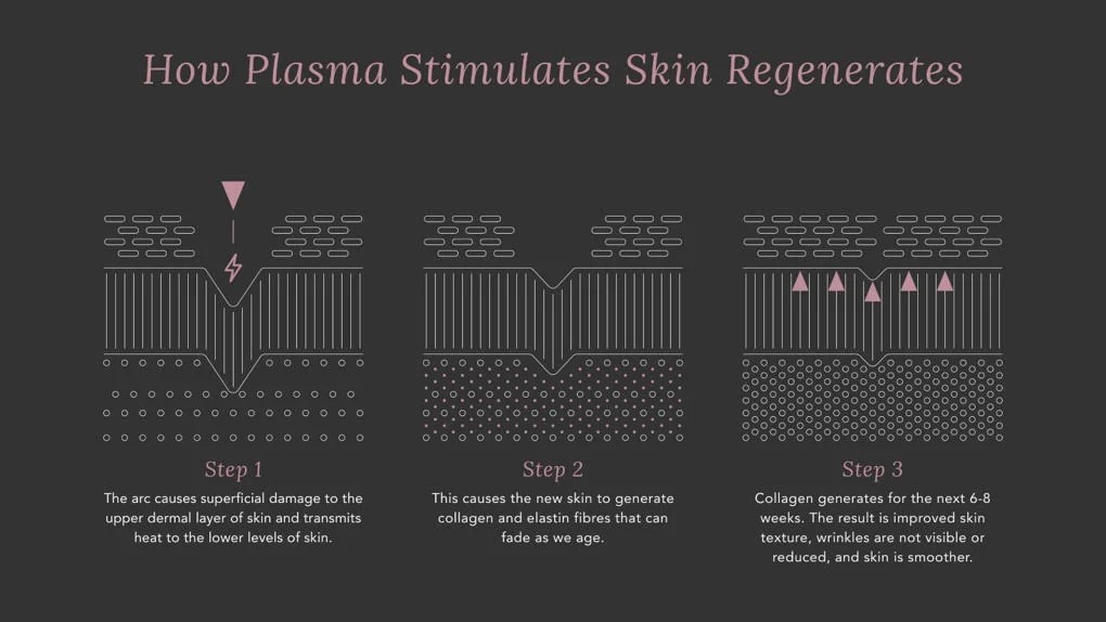 How Cold Plasma Stimulates Skin Regenerates